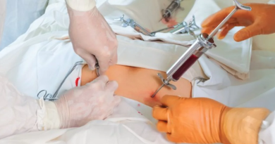 Exploring the World of Stem Cell Transplants